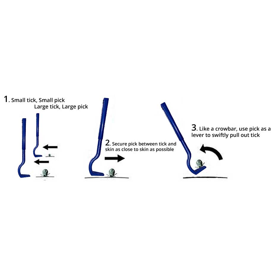 AtlanTick Tick ID & Removal