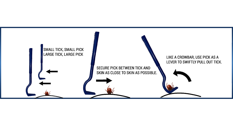 AtlanTick Tick Removal Kit